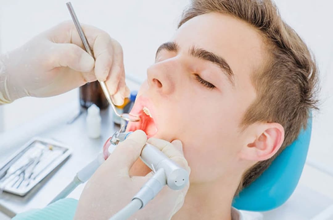 A Comprehensive Guide to Root Canal Treatment