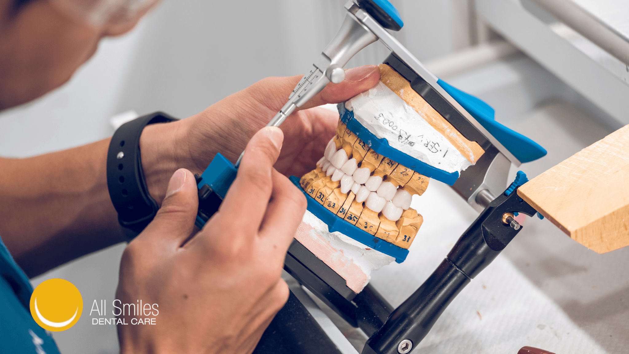 Dental Implants vs. Dentures_ Which is Better